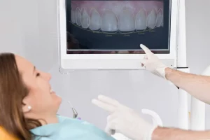 Pantalla scanner dental