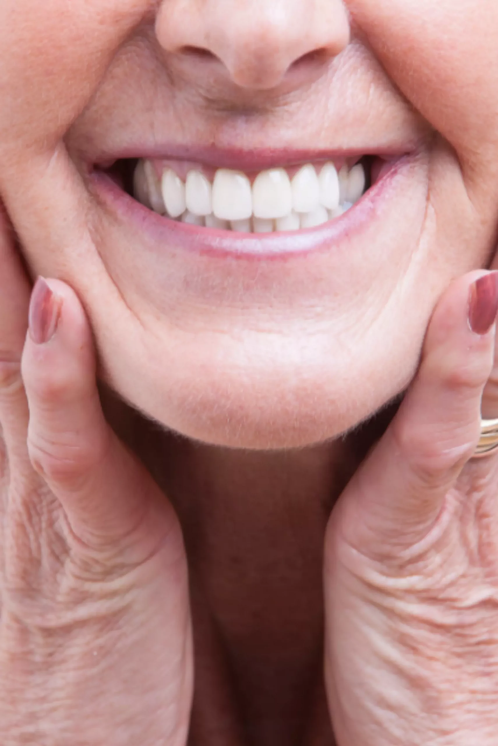Prótesis dental mujer mayor