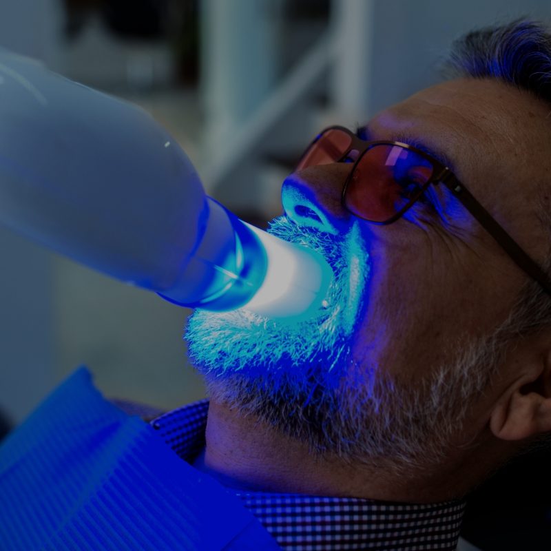 Blanqueamiento Dental
